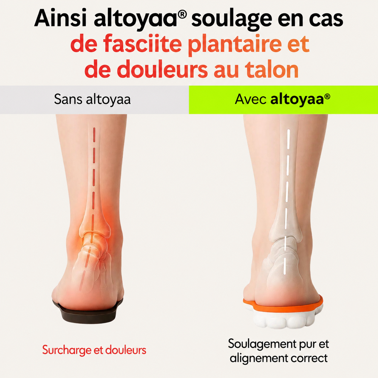 Semelles orthopédiques pour soulager les douleurs au talon et la fasciite plantaire
